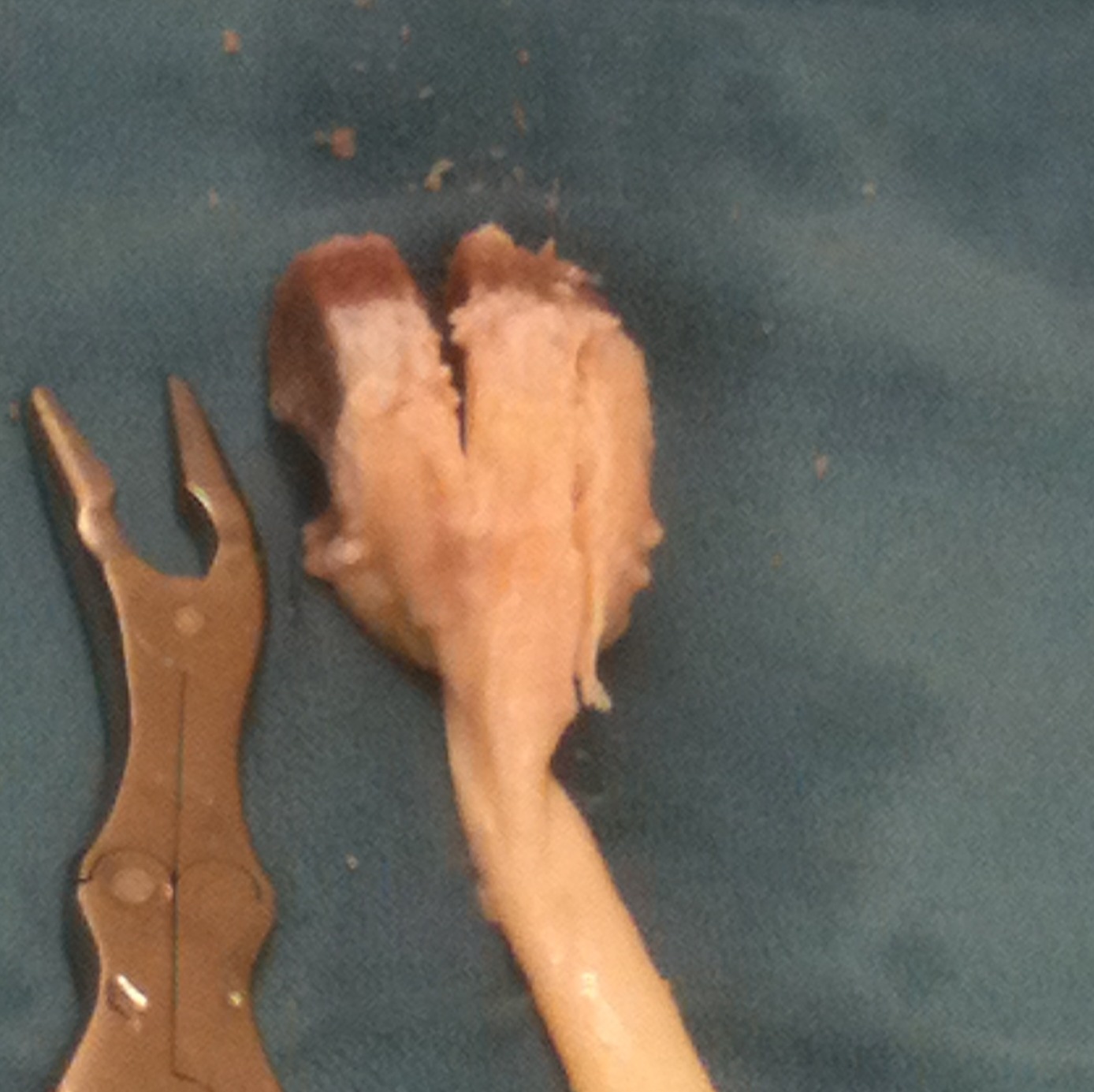 Achilles Allograft Saw Bone Block 2